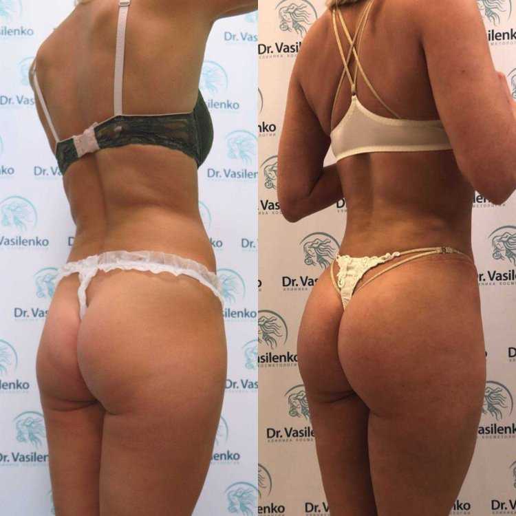 Разные ягодицы