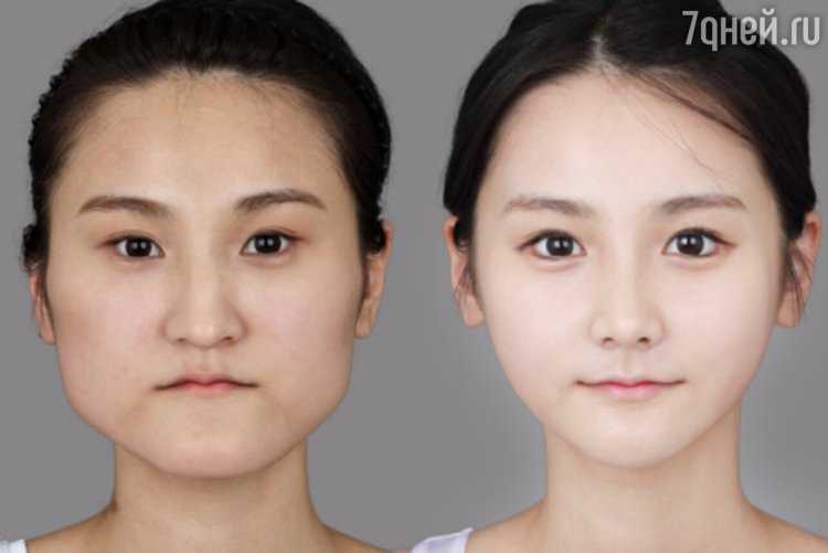 Кореянки Бефор Афтер