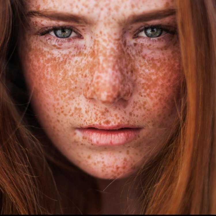 Тело в веснушках красивое
