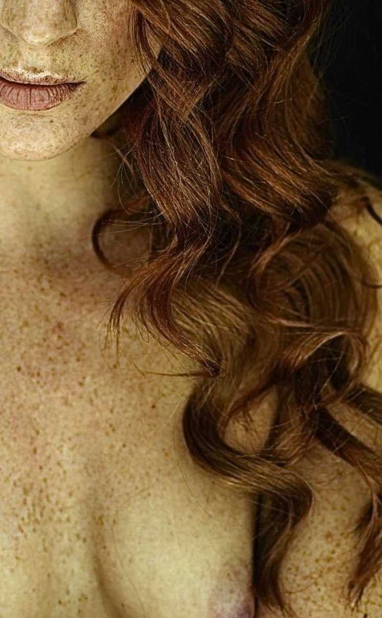 Веснушки на теле девушки