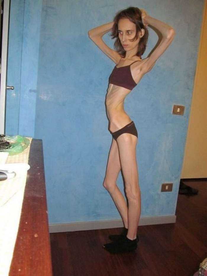 Тощие девушки на фото